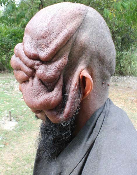side-face