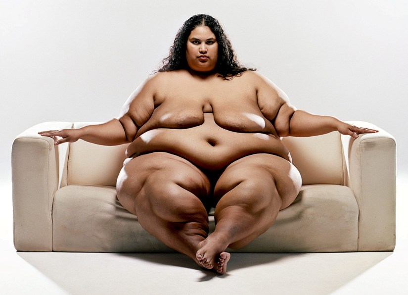 Obese_2