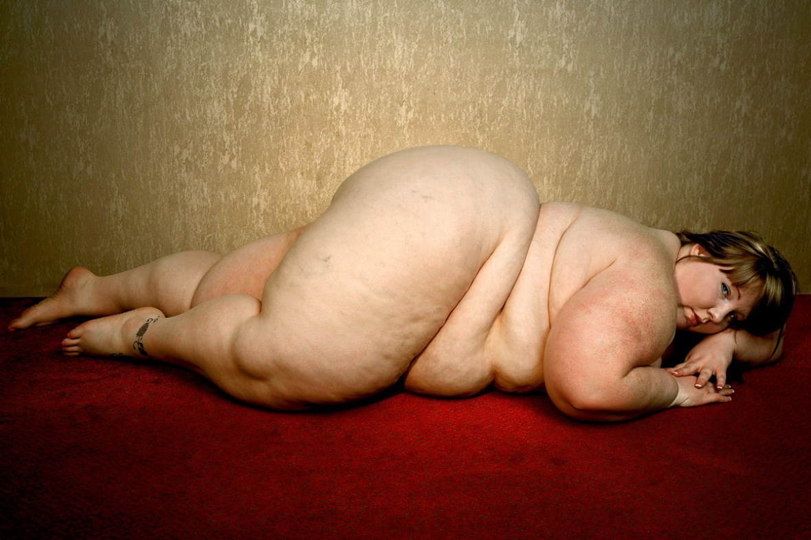 Obese_3