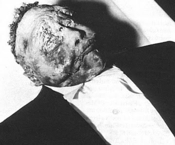 emmetttillcasket